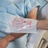 Health Care Logistics Pre-Op Mitt 7"X5-1/2", Properly Prepares a Patient for Surgery- Pack of 100 - Thumbnail Image 2